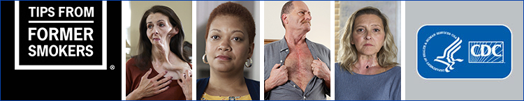 CDC's Tips from Former Smokers Montage